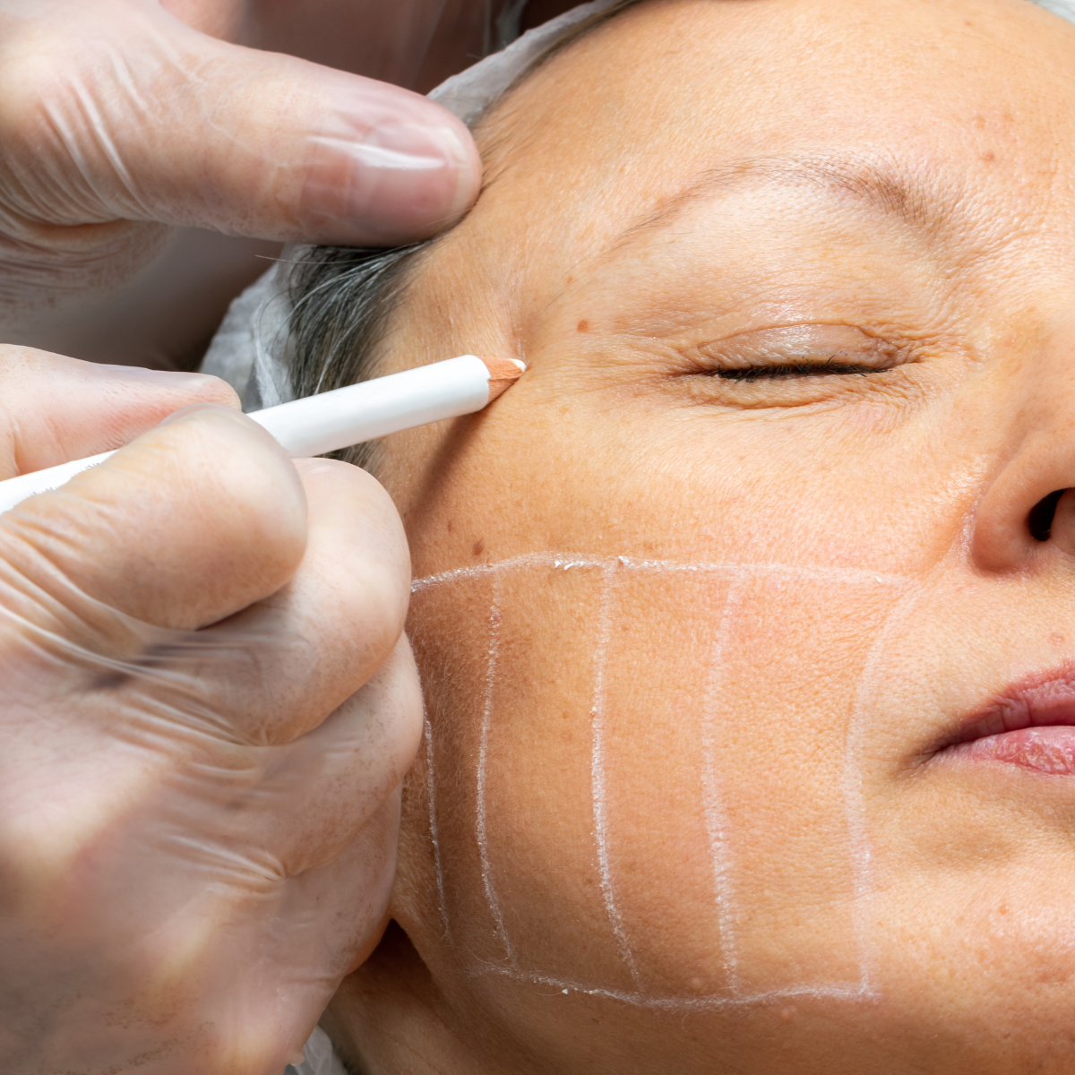 Ultrasonic 9D · Lifting Facial