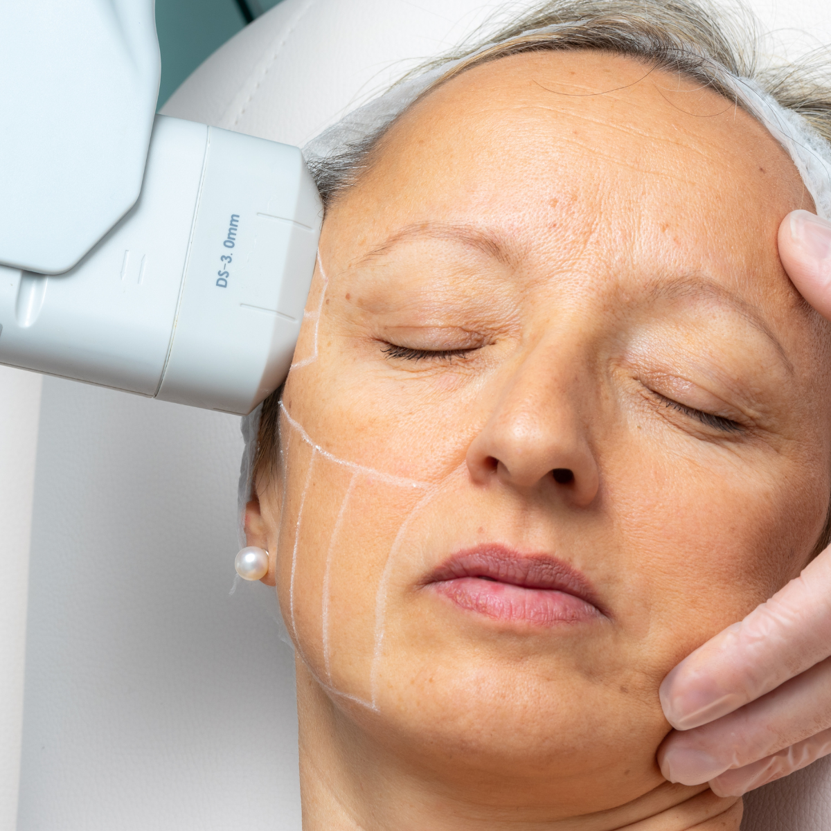 Ultrasonic 9D · Lifting Facial