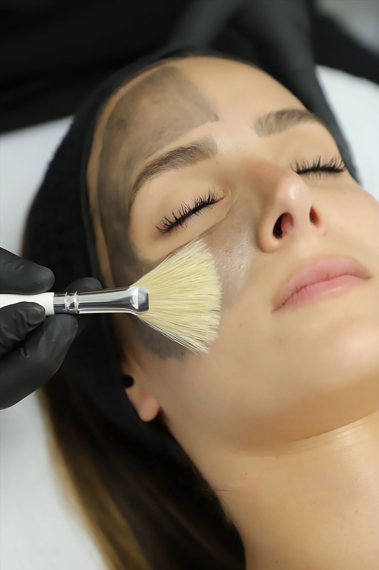 Laser Peel Carbono OFERTA FLASH