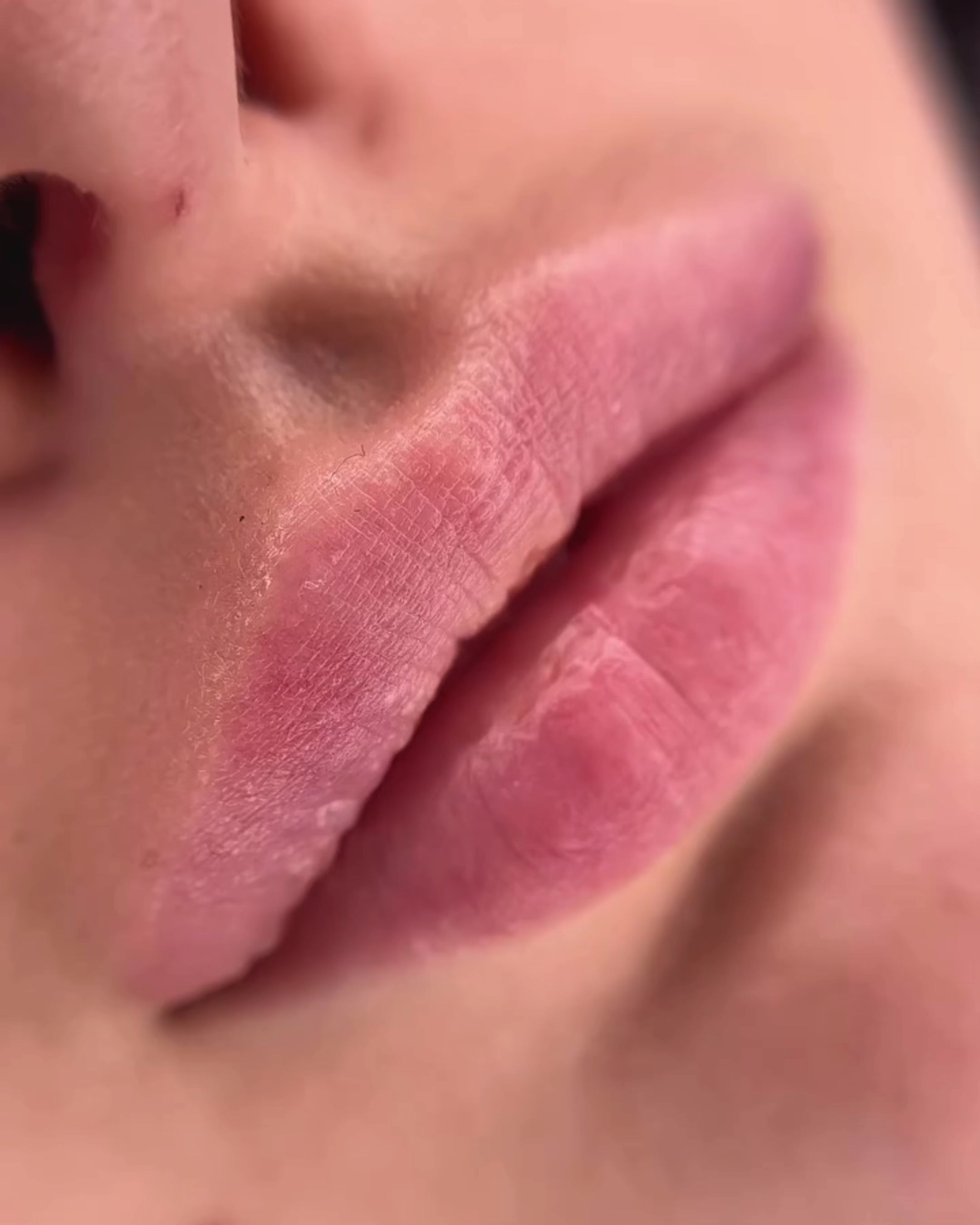 Labios Micro