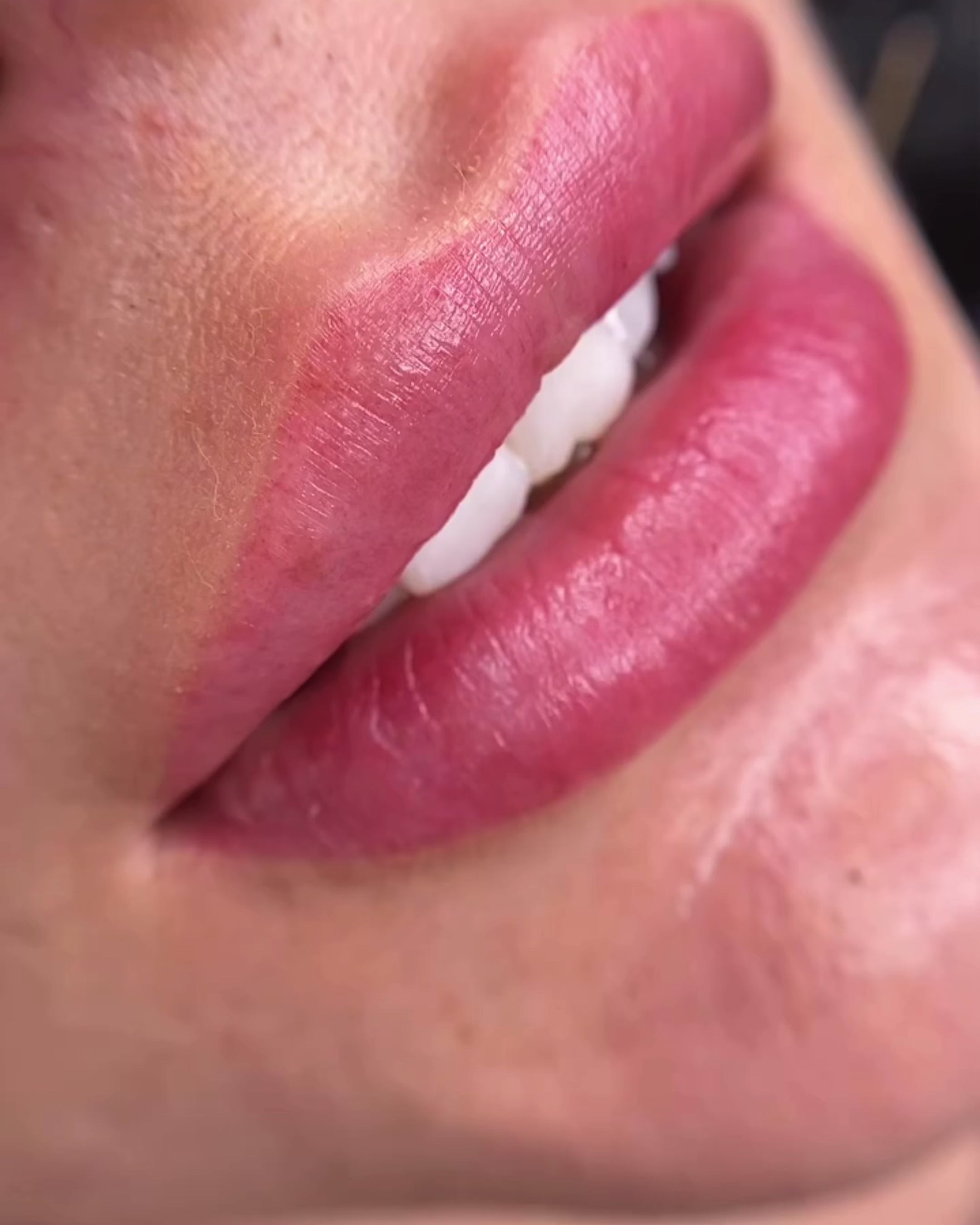 Labios Micro