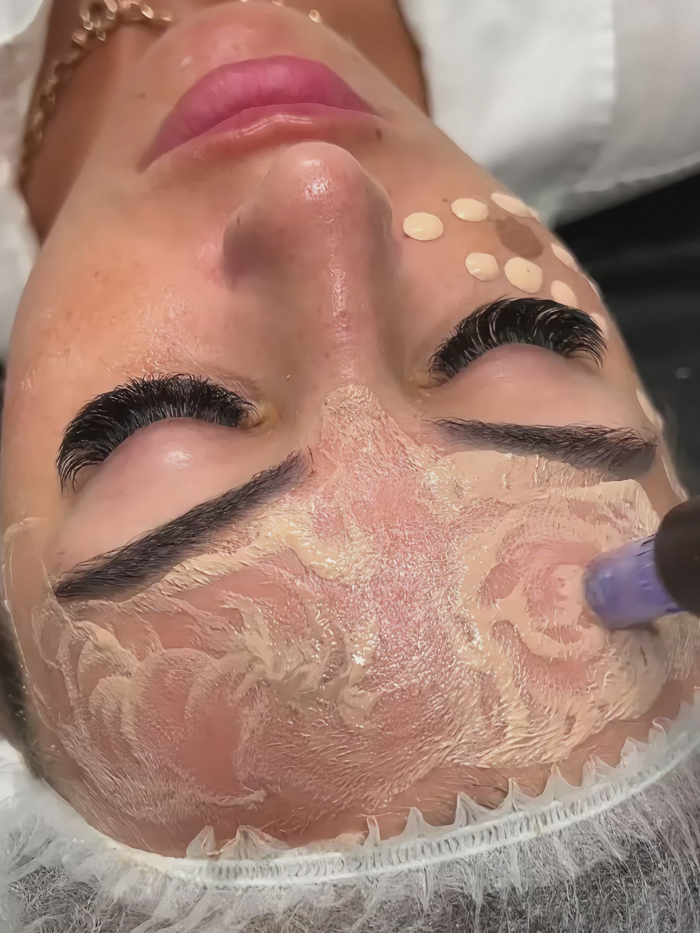 Micro Facial