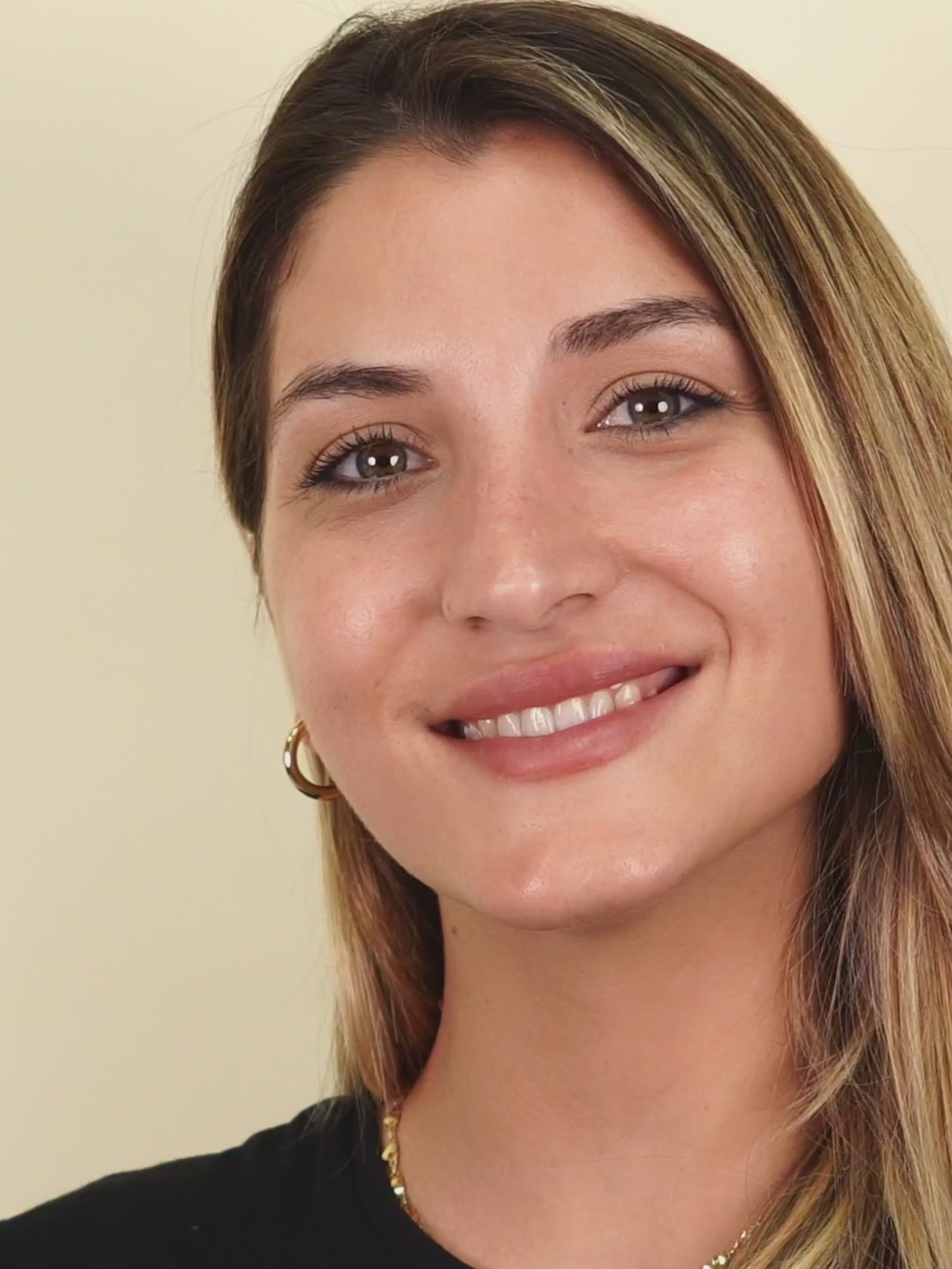 Laser Peel Carbono OFERTA FLASH