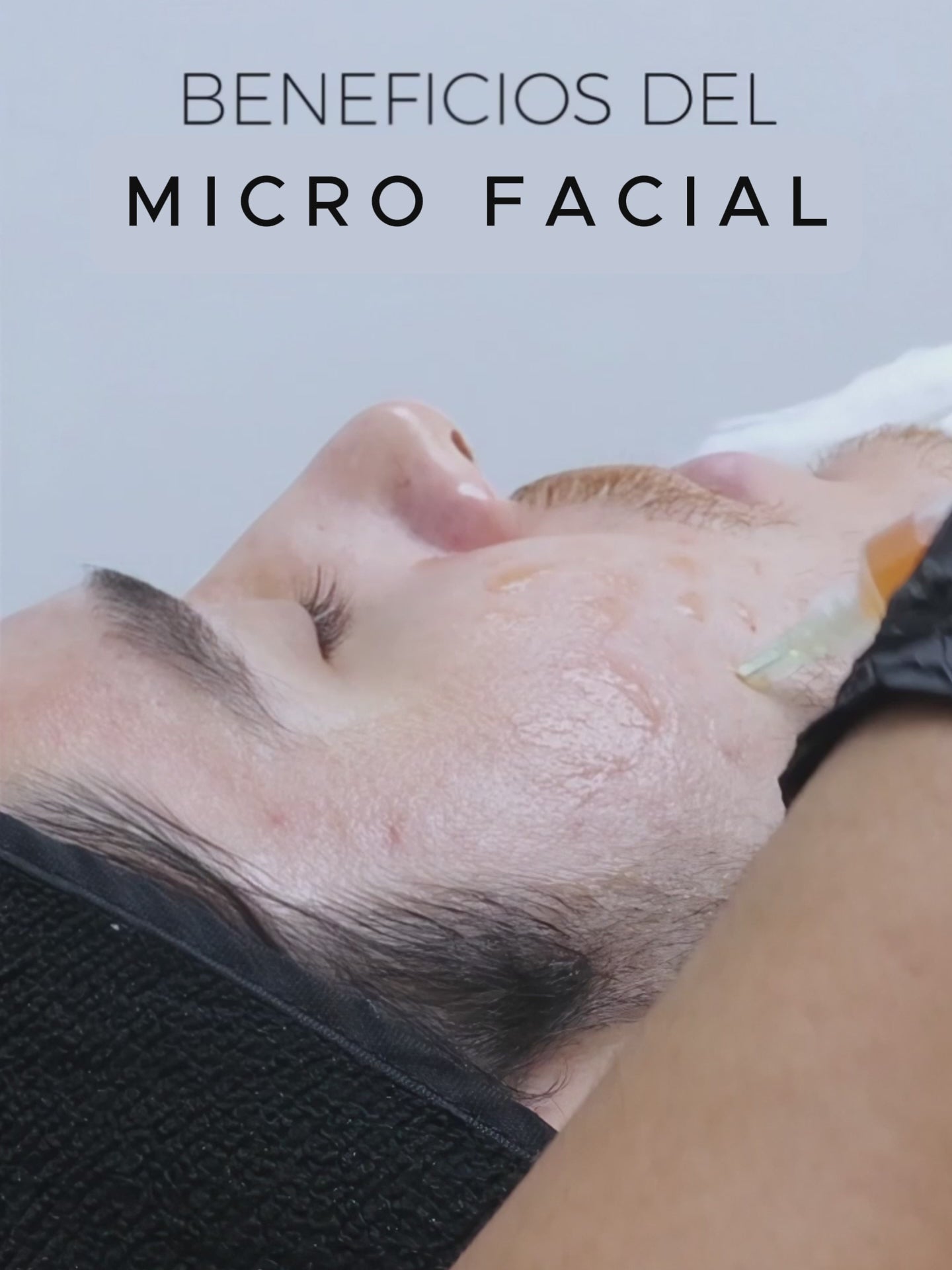 Micro Facial
