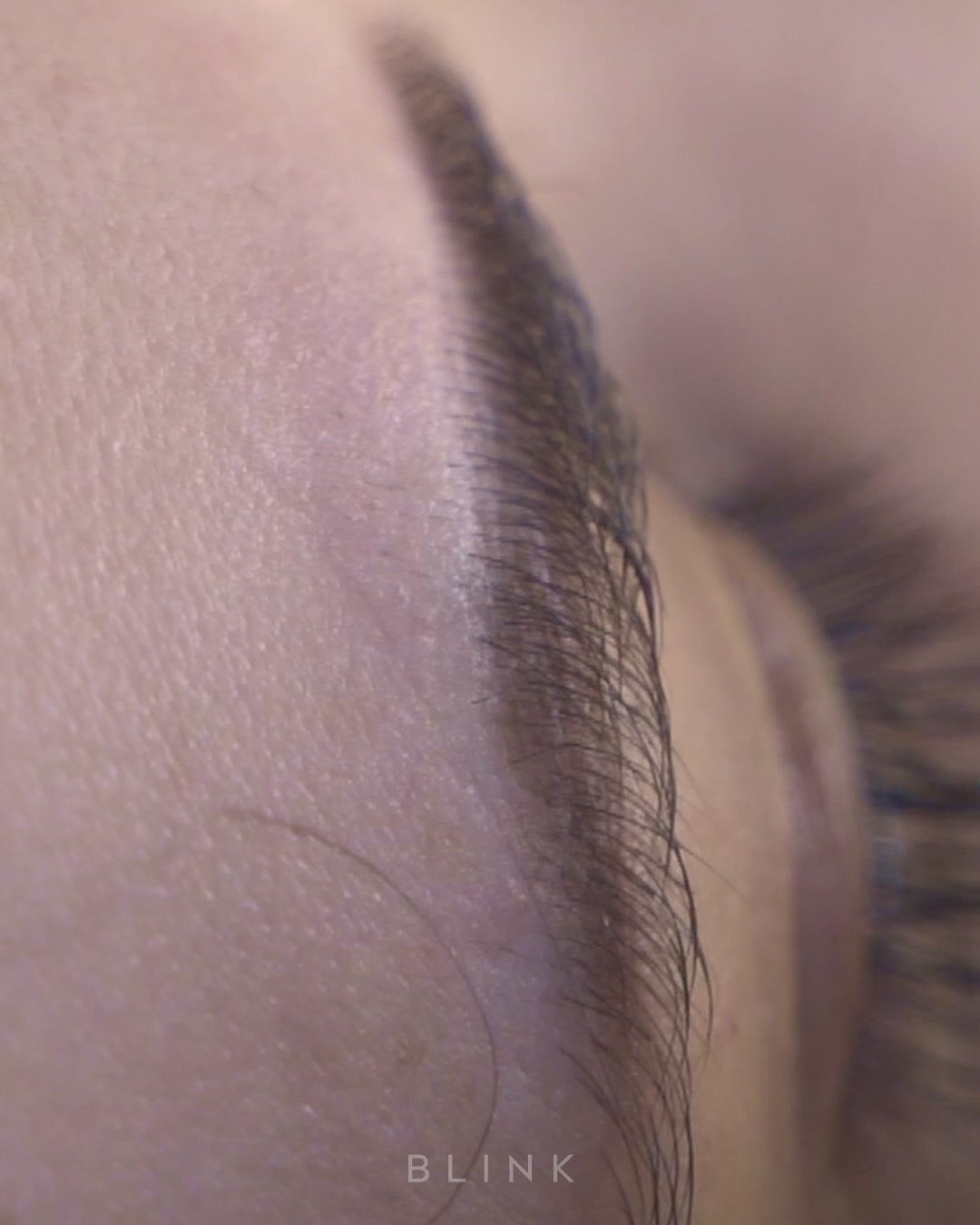 Depilación y Diseño